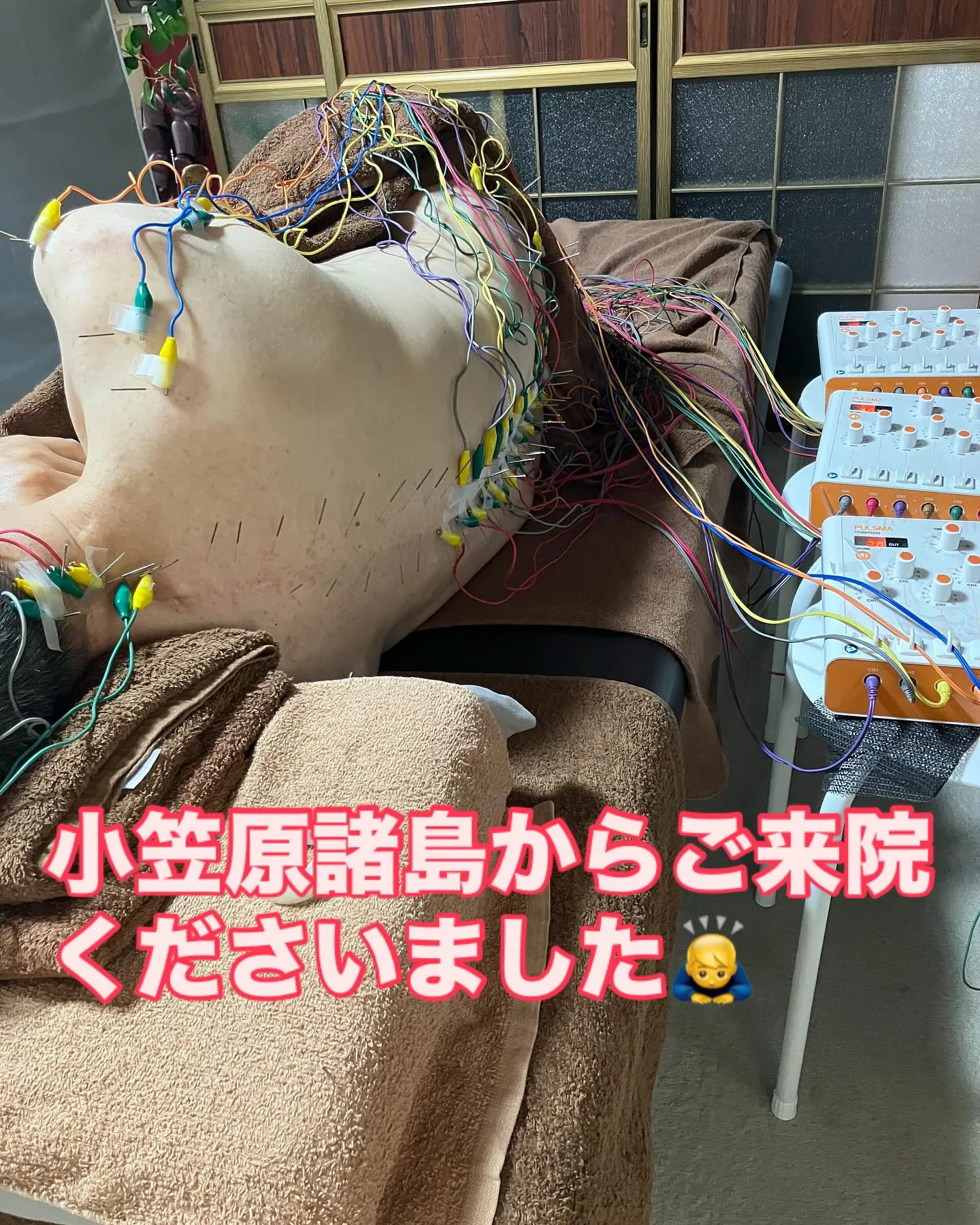 強直性脊髄炎の施術風景〜