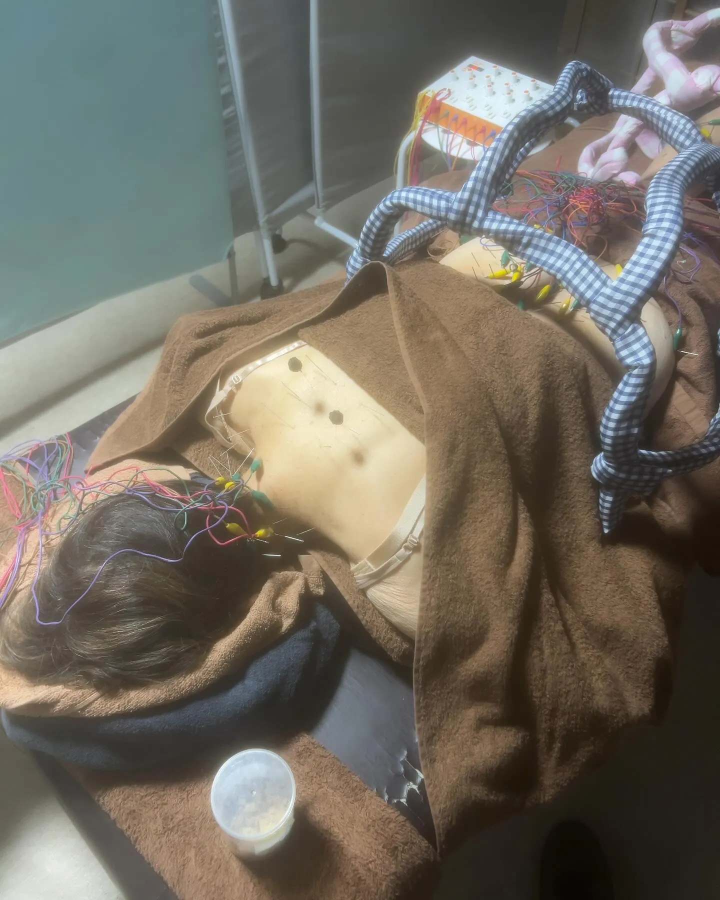 脊柱管狭窄、慢性の肩こり、味覚障害、胃痛に対する背術風景🤗