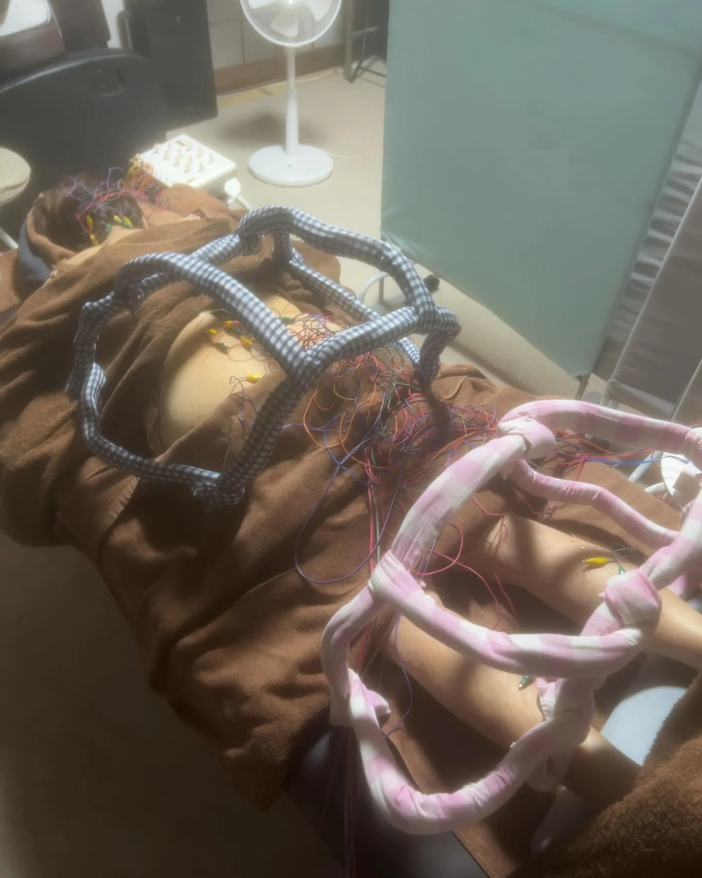 脊柱管狭窄、慢性の肩こり、味覚障害、胃痛に対する背術風景🤗