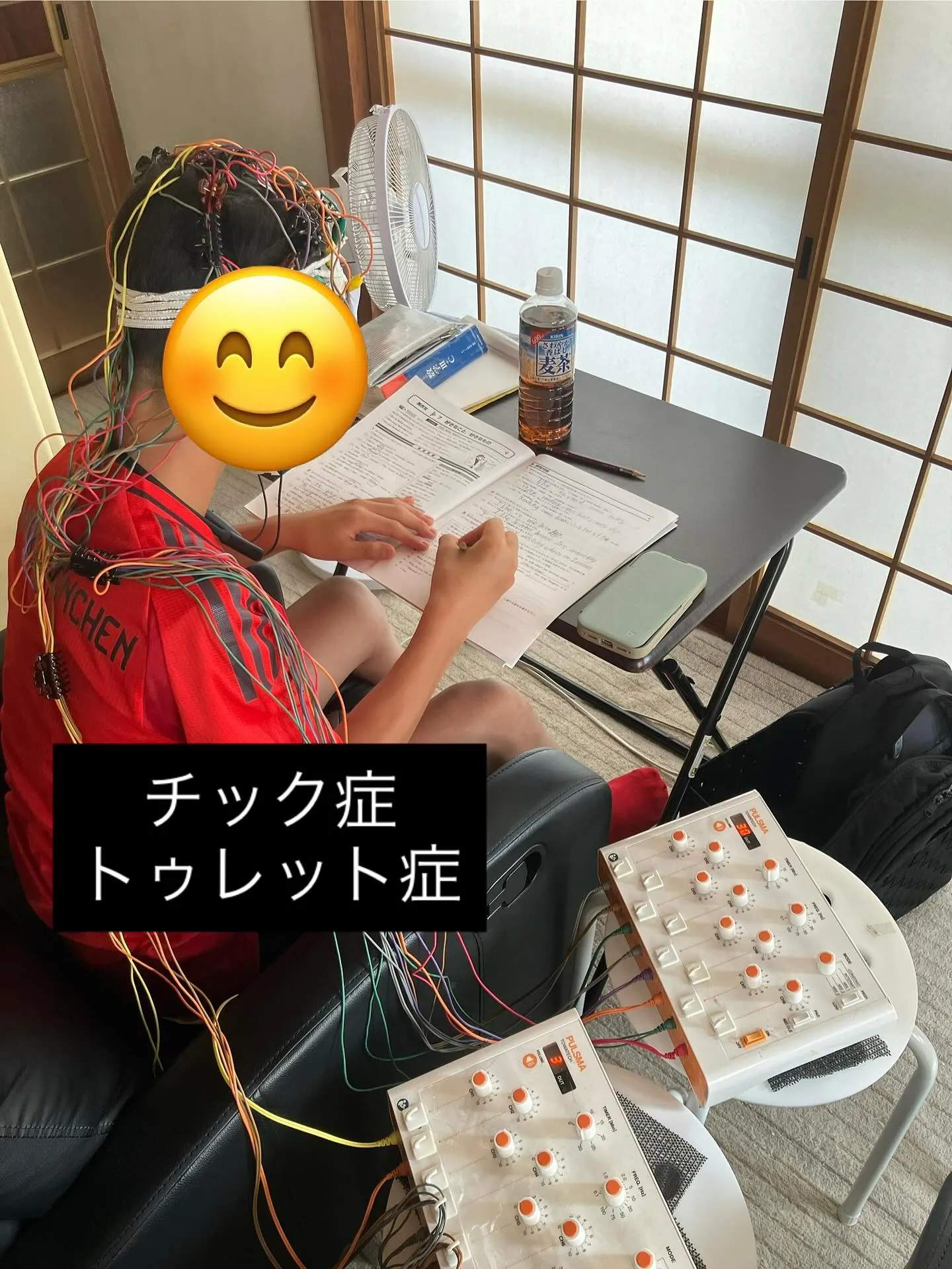 チック症トゥレット症施術風景☀️