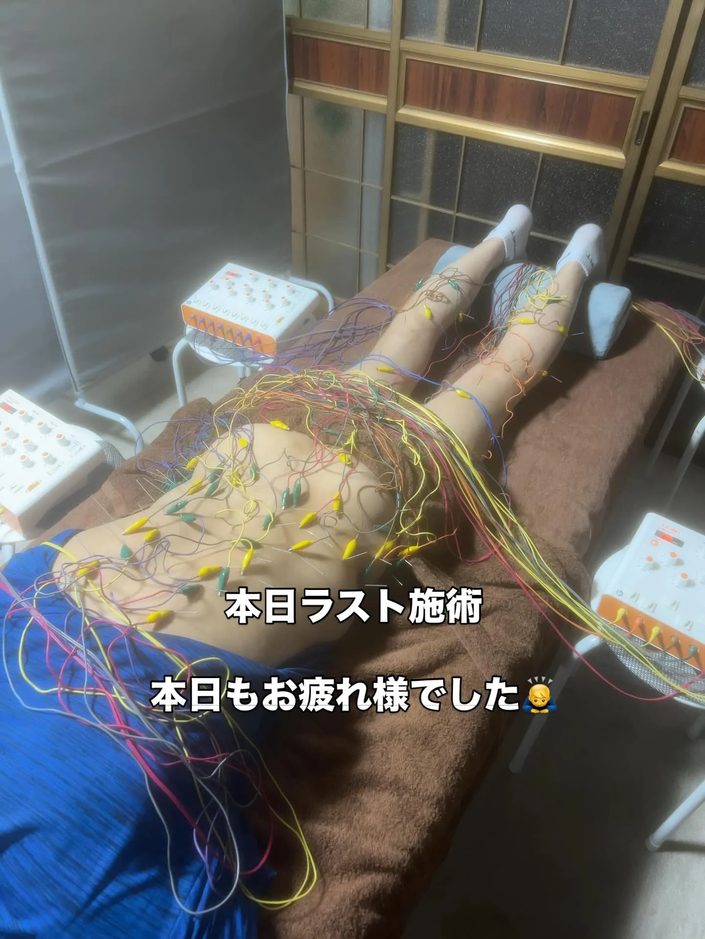 慢性腰痛　背中の張り