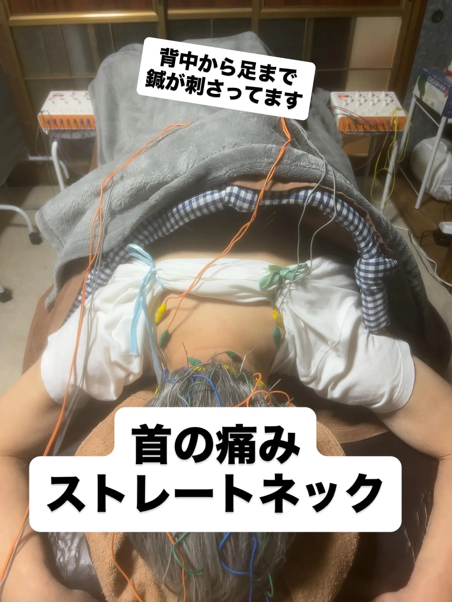 ストレートネック、腰痛、痺れ、腎臓