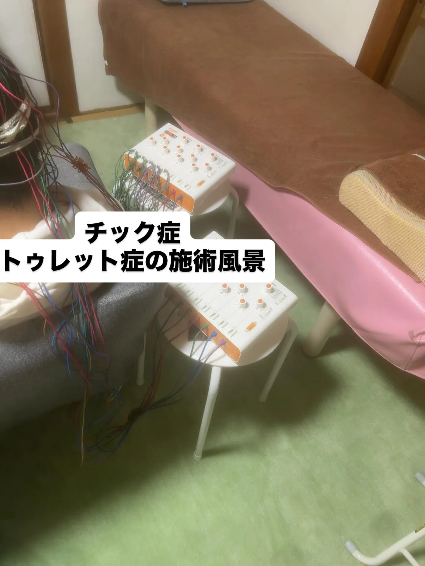 チック症の施術は座ってでもできます😆