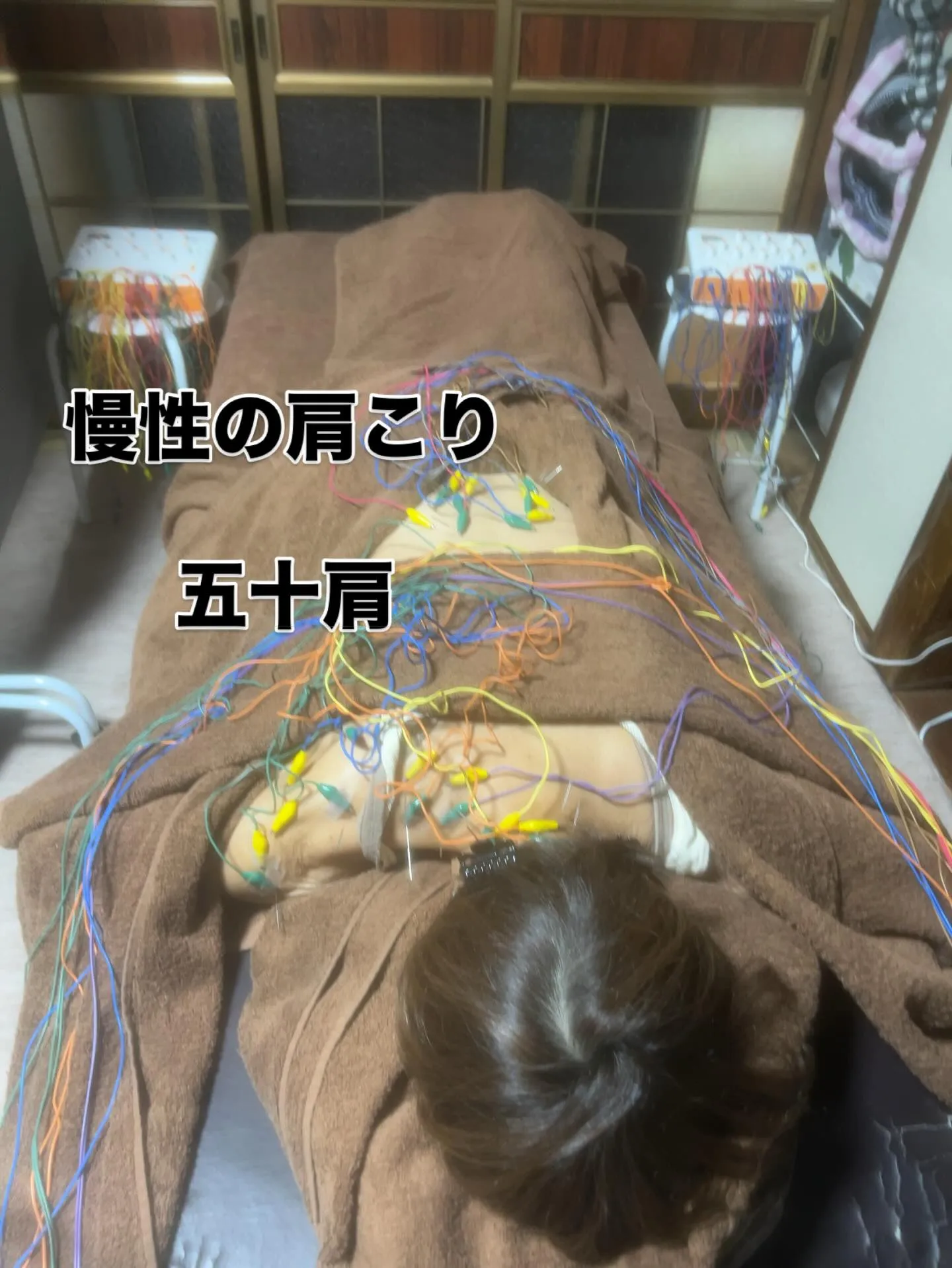 慢性の肩こり、五十肩、保険適応