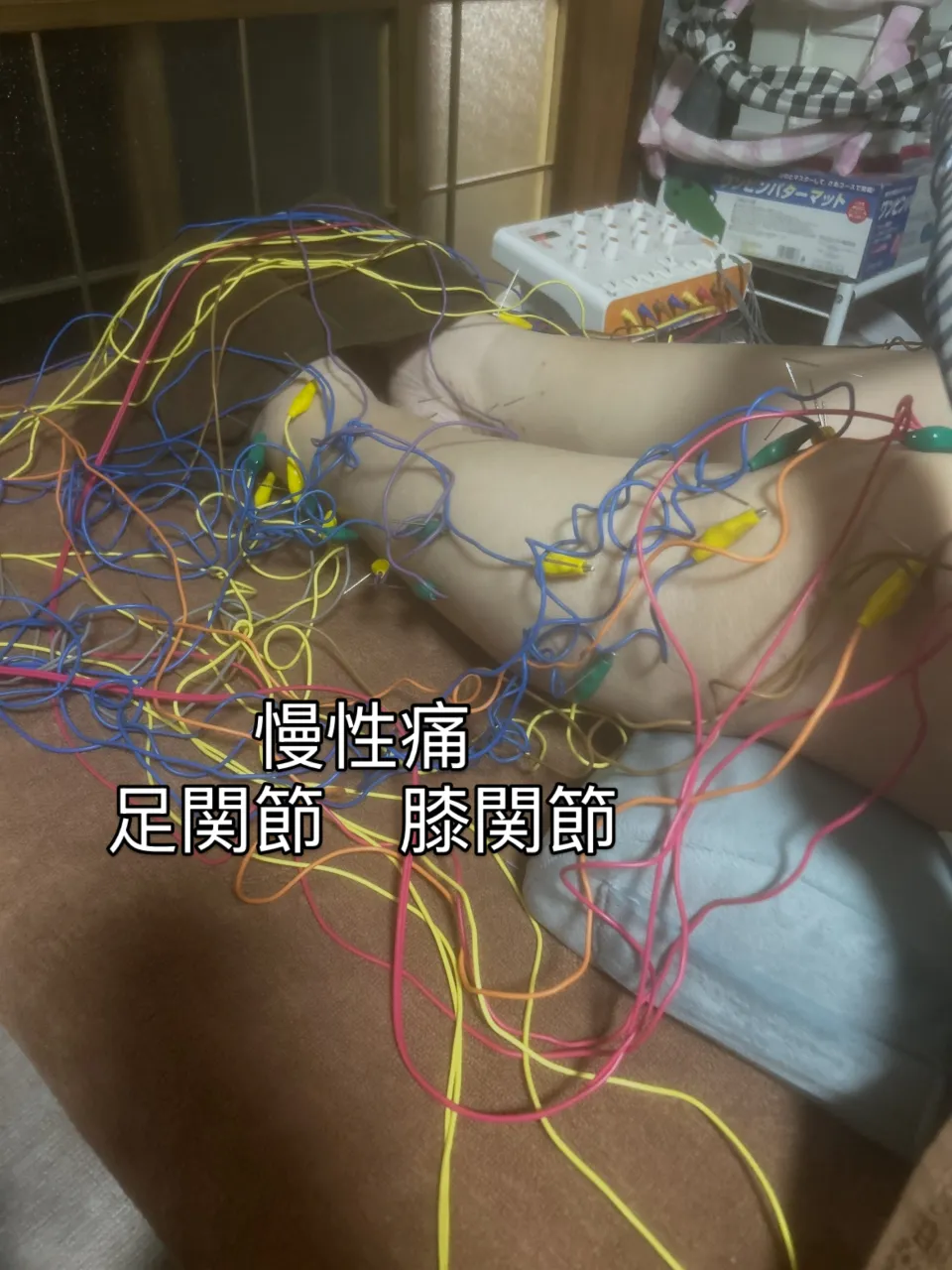 悪天候　慢性痛　自律神経